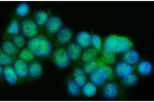 IF analysis of Presenilin 1/PS-1/PSEN1 using anti-Presenilin 1/PS-1/PSEN1 antibody (ABIN7599542). (Presenilin 1 抗体  (AA 1-76))