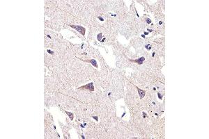 Immunohistochemical analysis of paraffin-embedded H. (FADS2 抗体  (AA 96-122))