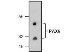 AP26353PU-N: Western blot analysis of PAX6 with rat kidney tissue lysate. (PAX6 抗体)