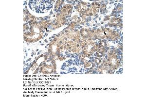 Human kidney (CHRNB2 抗体  (Middle Region))