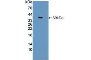 Western Blotting (WB) image for anti-Trefoil Factor 3 (Intestinal) (TFF3) (AA 23-81) antibody (ABIN7429235)