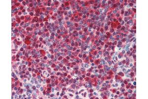 Anti-HSPA8 / HSC70 antibody IHC of human spleen.