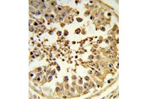 Formalin-fixed and paraffin-embedded human testis tissue reacted with DIAPH2 Antibody , which was peroxidase-conjugated to the secondary antibody, followed by DAB staining. (DIAPH2 抗体  (Middle Region))