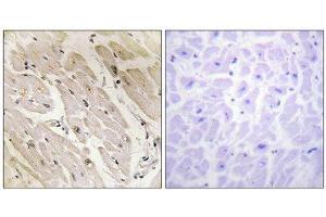 Immunohistochemistry (IHC) image for anti-Protein Kinase, AMP-Activated, gamma 2 Non-Catalytic Subunit (PRKAG2) (N-Term) antibody (ABIN1850045) (PRKAG2 抗体  (N-Term))