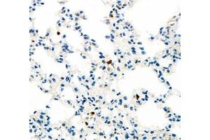 Immunohistochemistry (Paraffin-embedded Sections) (IHC (p)) image for anti-SIX Homeobox 1 (SIX1) antibody (ABIN7075617)