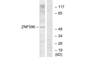 Western blot analysis of extracts from Jurkat cells, using ZNF596 antibody. (ZNF596 抗体  (Internal Region))