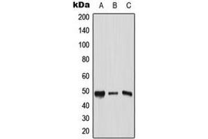 Western blot analysis of AP2 gamma expression in HeLa (A), Raw264. (TFAP2C 抗体  (C-Term))