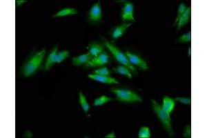Immunofluorescence staining of Hela cells with ABIN7149368 at 1:133, counter-stained with DAPI.