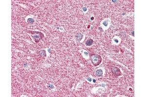 Anti-HK1 / Hexokinase 1 antibody IHC of human brain, cortex.
