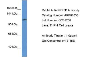 Western Blotting (WB) image for anti-Inositol Polyphosphate-5-Phosphatase, 145kDa (INPP5D) (C-Term) antibody (ABIN2774303) (INPP5D 抗体  (C-Term))
