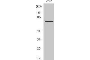 Western Blotting (WB) image for anti-Netrin 1 (NTN1) (C-Term) antibody (ABIN3176270) (Netrin 1 抗体  (C-Term))