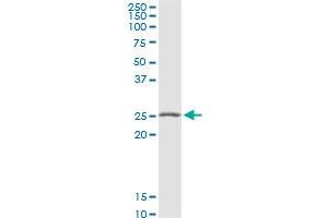 VTI1B MaxPab rabbit polyclonal antibody.