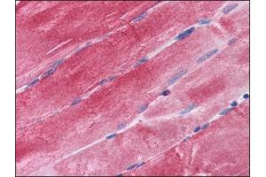 Immunohistochemistry Image: Human Skeletal Muscle: Formalin-Fixed, Paraffin-Embedded (FFPE) (BAG3 抗体  (C-Term))