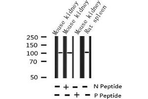Western blot analysis of Phospho-NF kappaB p105/p50 (Ser932) expression in various lysates (NFKB1 抗体  (pSer932))