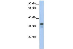 GLYATL2 antibody used at 1 ug/ml to detect target protein. (GLYATL2 抗体  (Middle Region))