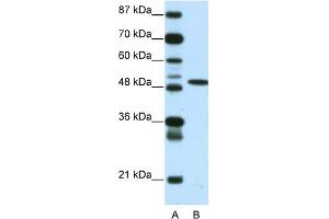 WB Suggested Anti-ETV5 Antibody Titration:  0. (ETV5 抗体  (N-Term))