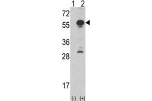 Western Blotting (WB) image for anti-Inhibin, alpha (INHA) antibody (ABIN3002774) (Inhibin alpha 抗体)