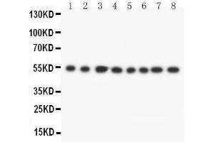 Lane 8: JURKAT Cell Lysate (DLD 抗体  (C-Term))