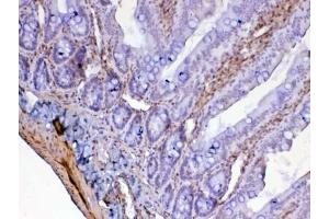 IHC testing of FFPE rat small intestine tissue with Galectin 1 antibody at 1ug/ml. (LGALS1/Galectin 1 抗体)