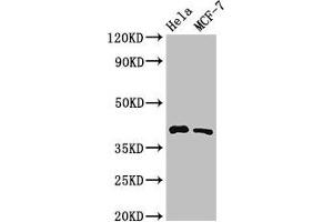 Western Blot Positive WB detected in: Hela whole cell lysate, MCF-7 whole cell lysate All lanes: HLA-B antibody at 3. (HLA-B 抗体  (AA 197-306))
