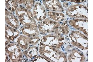 Immunohistochemical staining of paraffin-embedded Human prostate tissue using anti-ACAT2 mouse monoclonal antibody. (ACAT2 抗体)