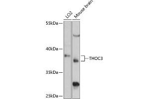 Western blot analysis of extracts of various cell lines, using THOC3 antibody (ABIN6128824, ABIN6149117, ABIN6149118 and ABIN6217153) at 1:3000 dilution. (THO Complex 3 抗体  (AA 1-200))