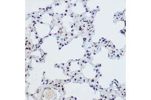 Immunohistochemistry of paraffin-embedded Mouse lung using PLZF antibody (ABIN6128472, ABIN6150368, ABIN6150369 and ABIN6221570) at dilution of 1:200 (40x lens). (ZBTB16 抗体  (AA 1-220))
