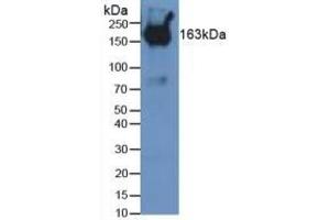 Detection of PZP in Mouse Serum using Polyclonal Antibody to Pregnancy Zone Protein (PZP) (PZP 抗体  (AA 1224-1495))