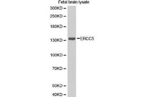 Western Blotting (WB) image for anti-DNA Repair Protein Complementing XP-G Cells (ERCC5) (AA 1-270) antibody (ABIN1512873) (ERCC5 抗体  (AA 1-270))