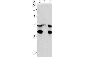 Western Blotting (WB) image for anti-Coiled-Coil Domain Containing 99 (CCDC99) antibody (ABIN2422193) (CCDC99 抗体)
