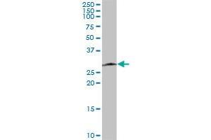 SPC25 MaxPab polyclonal antibody. (SPC25 抗体  (AA 1-224))