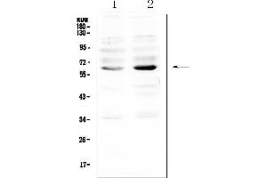 Western blot analysis of NRF1 using anti-NRF1 antibody (ABIN6719347).