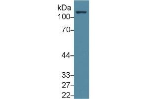 Detection of FAK in Human Jurkat cell lysate using Polyclonal Antibody to Focal Adhesion Kinase (FAK) (FAK 抗体  (AA 798-1041))