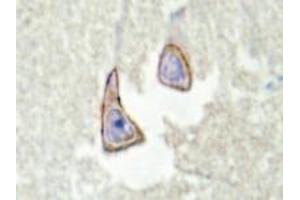 Immunohistochemistry analysis of KSR2 in human brain tissue (Formalin-fixed, Paraffin-embedded) using Kinase suppressor of Ras 2 antibody . (KSR2 抗体)