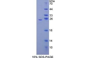 SDS-PAGE analysis of Mouse NFkB2 Protein. (Nuclear Factor kappa B2 蛋白)
