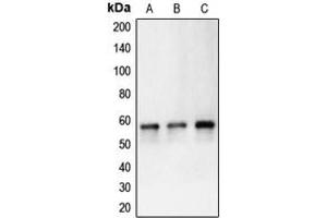 Western blot analysis of Carbonic Anhydrase 9 expression in HeLa (A), Ramos (B), Molt4 (C) whole cell lysates. (CA9 抗体  (Center))