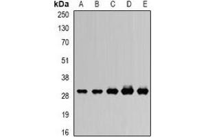 Western blot analysis of RISP expression in SW620 (A), MCF7 (B), mouse heart (C), mouse ovary (D), rat kidney (E) whole cell lysates. (UQCRFS1 抗体)