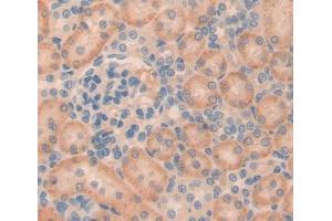 #VALUE! (Phospholipase C beta 2 抗体  (AA 1-250))