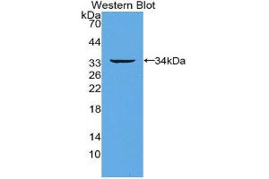 Western Blotting (WB) image for anti-Tumor Necrosis Factor Receptor Superfamily, Member 11a, NFKB Activator (TNFRSF11A) (AA 330-615) antibody (ABIN1860401) (TNFRSF11A 抗体  (AA 330-615))