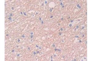 Used in DAB staining on fromalin fixed paraffin- embedded kidney tissue (UCP2 抗体  (AA 154-289))