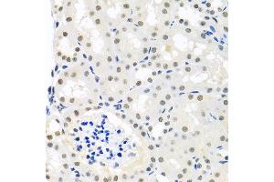 Immunohistochemistry of paraffin-embedded mouse kidney using THOC1 antibody at dilution of 1:100 (x40 lens). (THOC1 抗体)