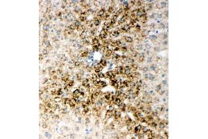 Immunohistochemistry (IHC) image for anti-One Cut Homeobox 1 (ONECUT1) (AA 187-203), (N-Term) antibody (ABIN3044467)