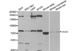 Western Blotting (WB) image for anti-P Protein (OCA2) antibody (ABIN1876854) (OCA2 抗体)