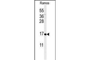 Western blot analysis of CMTM7 Antibody in Ramos cell line lysates (35ug/lane) (CMTM7 抗体  (N-Term))