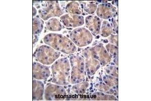 Immunohistochemistry (Paraffin-embedded Sections) (IHC (p)) image for anti-Galactosamine (N-Acetyl)-6-Sulfate Sulfatase (GALNS) (AA 236-263) antibody (ABIN655593)
