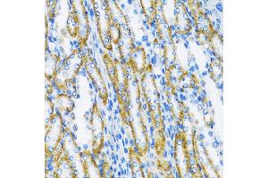 Immunohistochemistry of paraffin-embedded Mouse kidney using DNA Polymerase beta antibody (ABIN3022384, ABIN3022385, ABIN3022386, ABIN1513390 and ABIN1514536) at dilution of 1:100 (40x lens). (POLB 抗体  (AA 1-335))