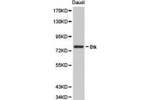 Western Blotting (WB) image for anti-Bruton Agammaglobulinemia tyrosine Kinase (BTK) antibody (ABIN1871367) (BTK 抗体)