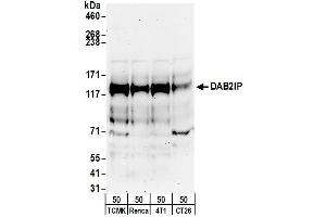 anti-DAB2 Interacting Protein (DAB2IP) (AA 850-900) antibody