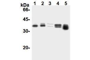 Western Blotting (WB) image for anti-Cyclin D1 (CCND1) antibody (ABIN1106871) (Cyclin D1 抗体)