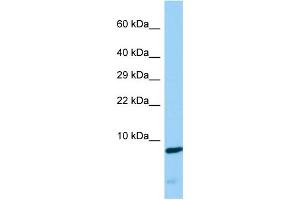 Host: Rabbit Target Name: CDC42SE2 Sample Type: COLO205 Whole Cell lysates Antibody Dilution: 1. (CDC42SE2 抗体  (Middle Region))